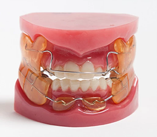 Can Invisalign Actually Fix An Overbite? - Impact Orthodontics