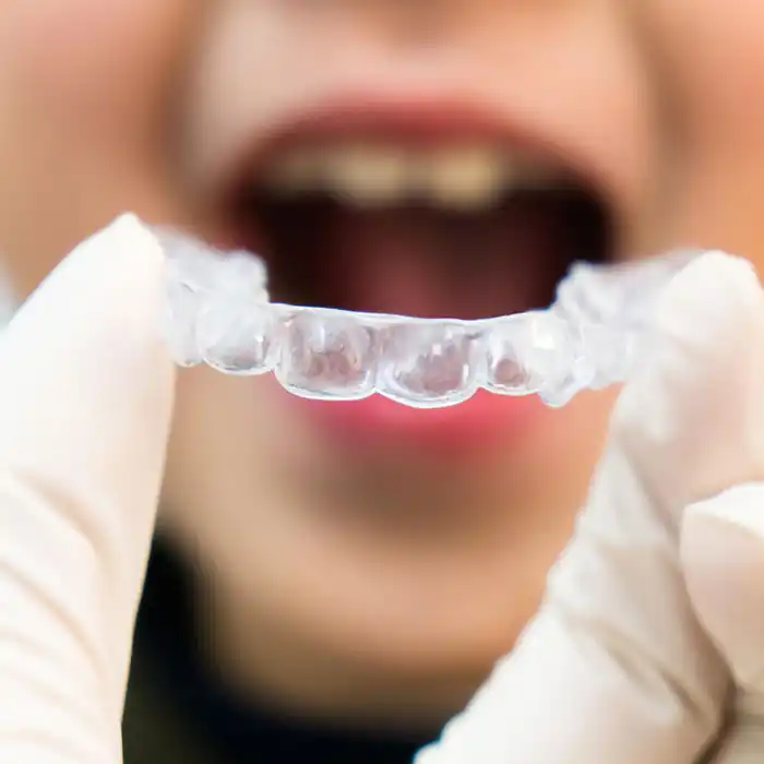 Teeth Alignment Calgary  Invisalign Braces - Impact Orthodontics