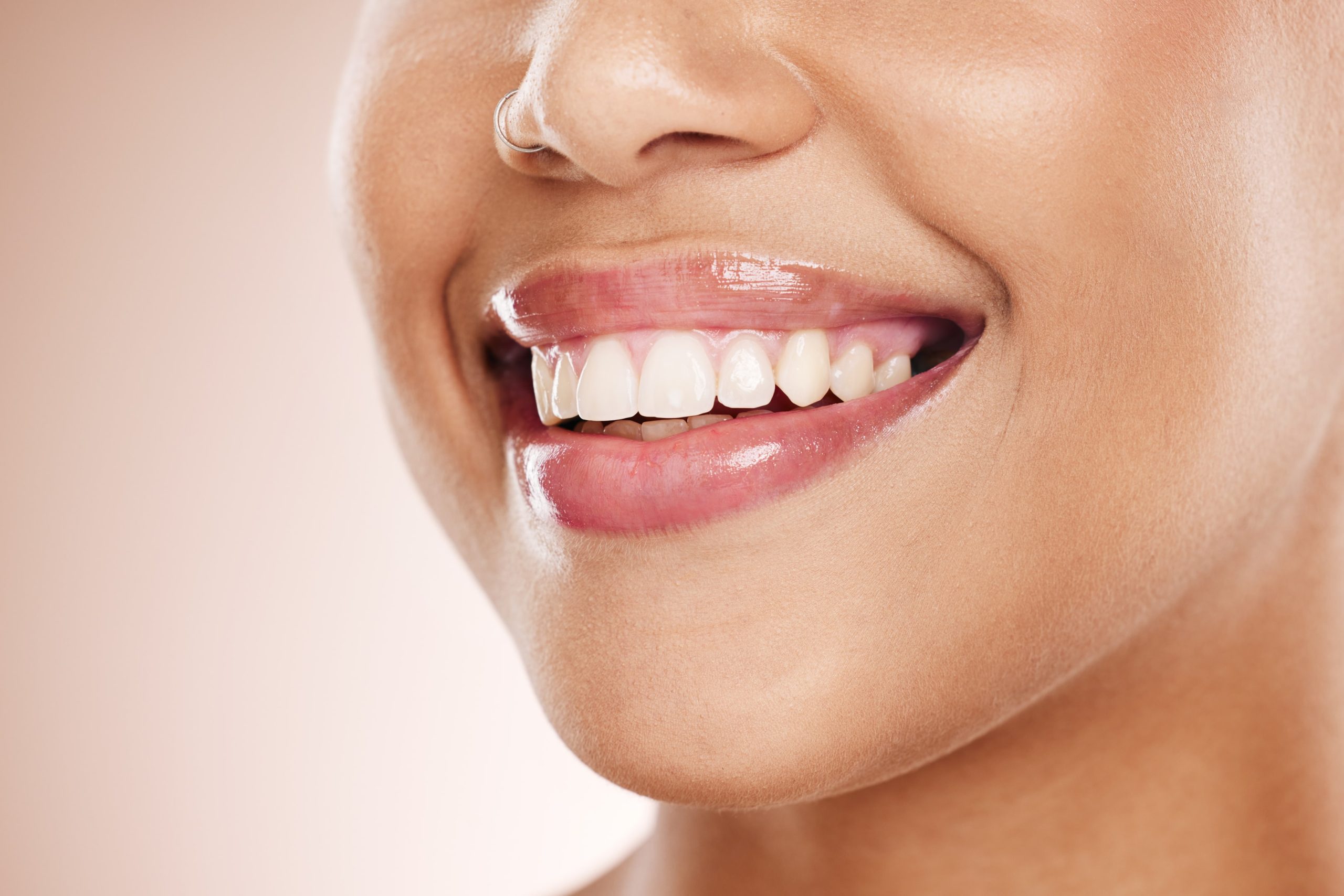 Woman smiling with straight top teeth