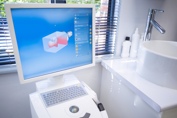 Itero scanning technology used to create 3D digital models of orthodontic patient's teeth