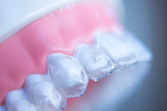 close up of Invisalign trays on model teeth