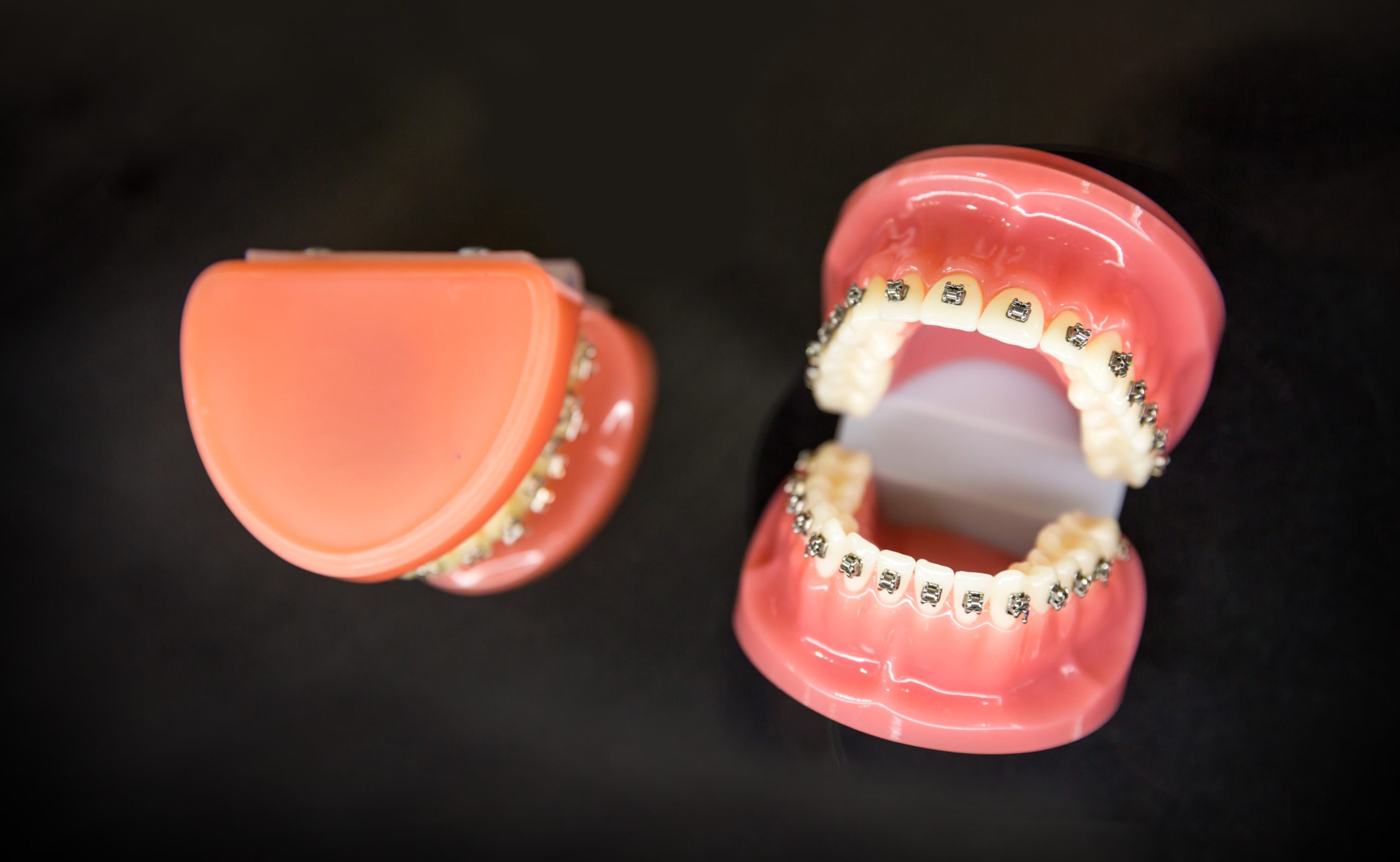 Dental models 