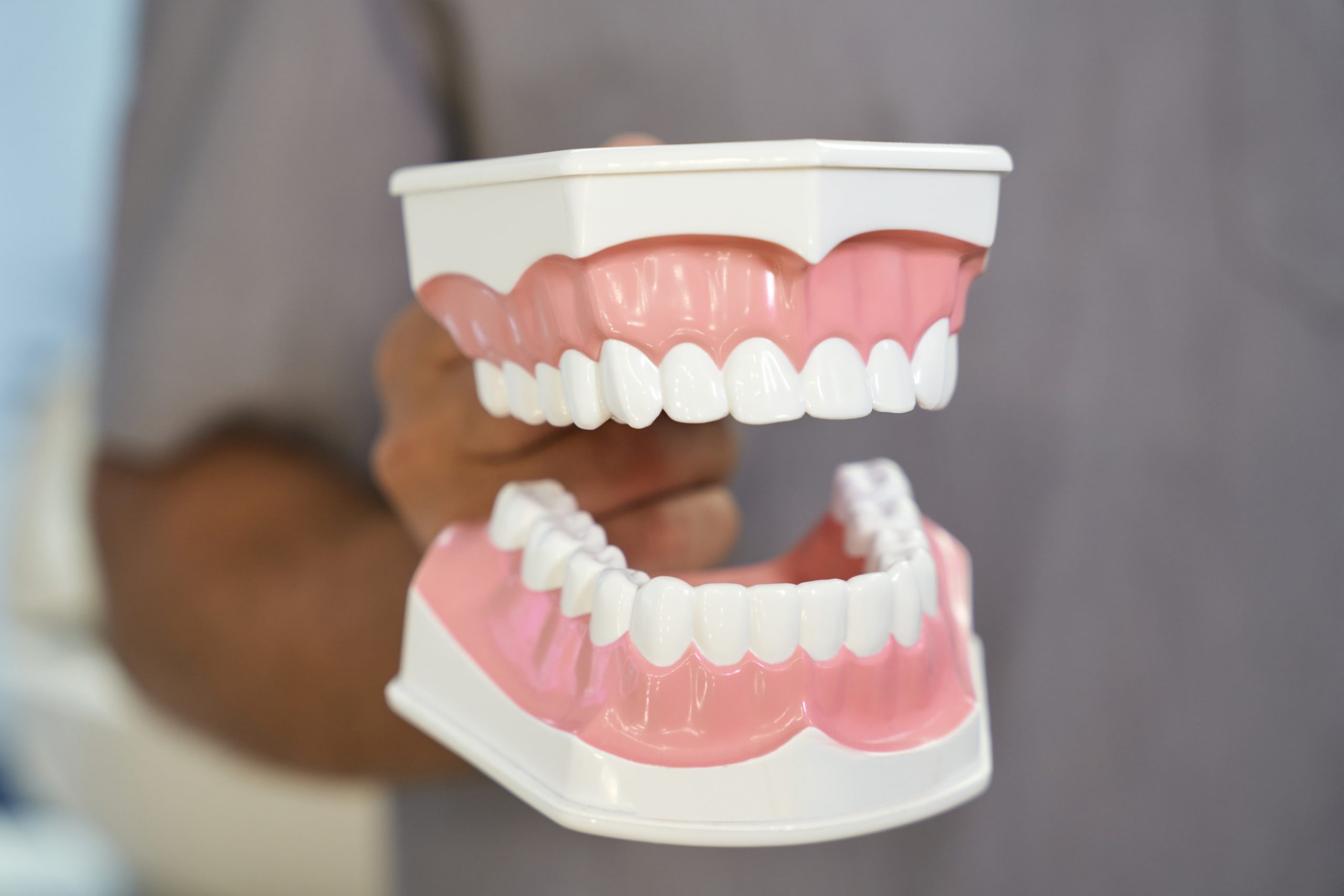 Dental model showing a correct bite