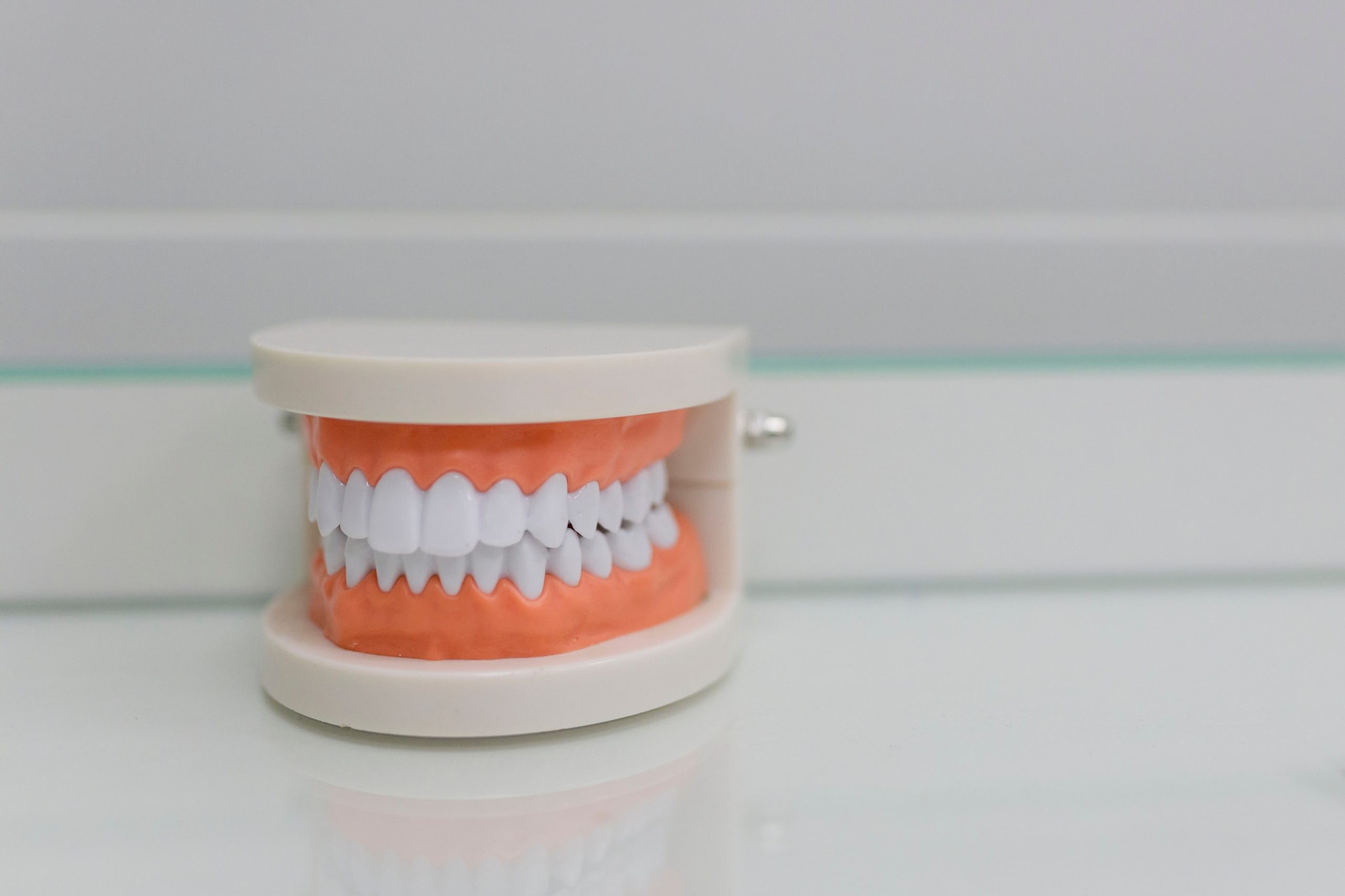 Dental models showing a correct bite