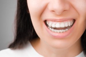 woman smiling while wearing Invisalign