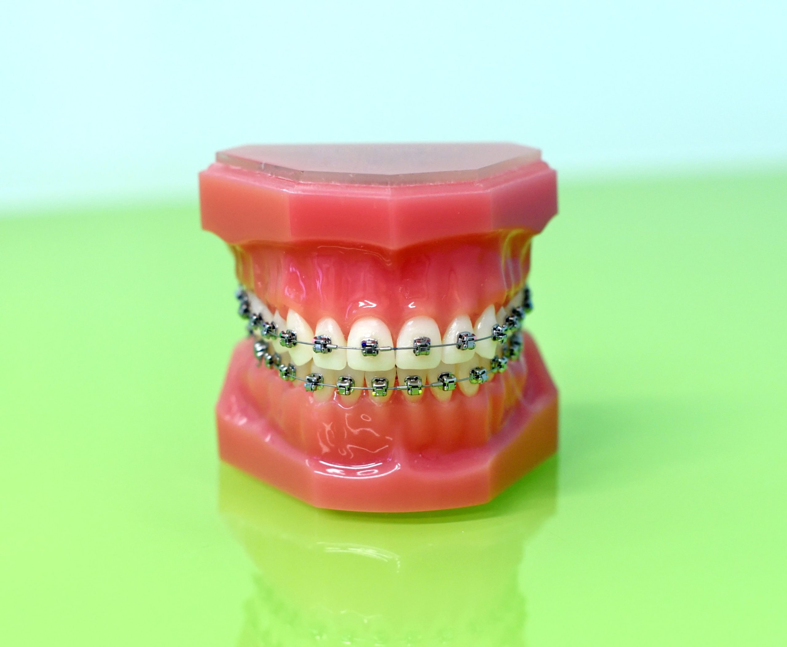 Dental model wearing braces