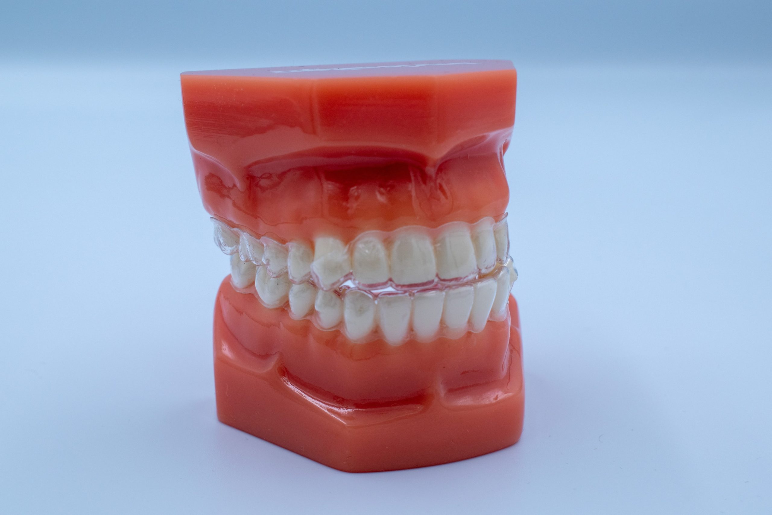 Dental model showing the Invisalign process