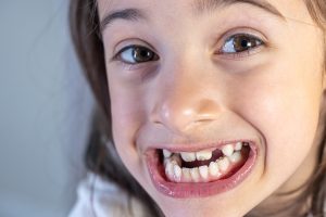 Kid smiling with lower jaw forward