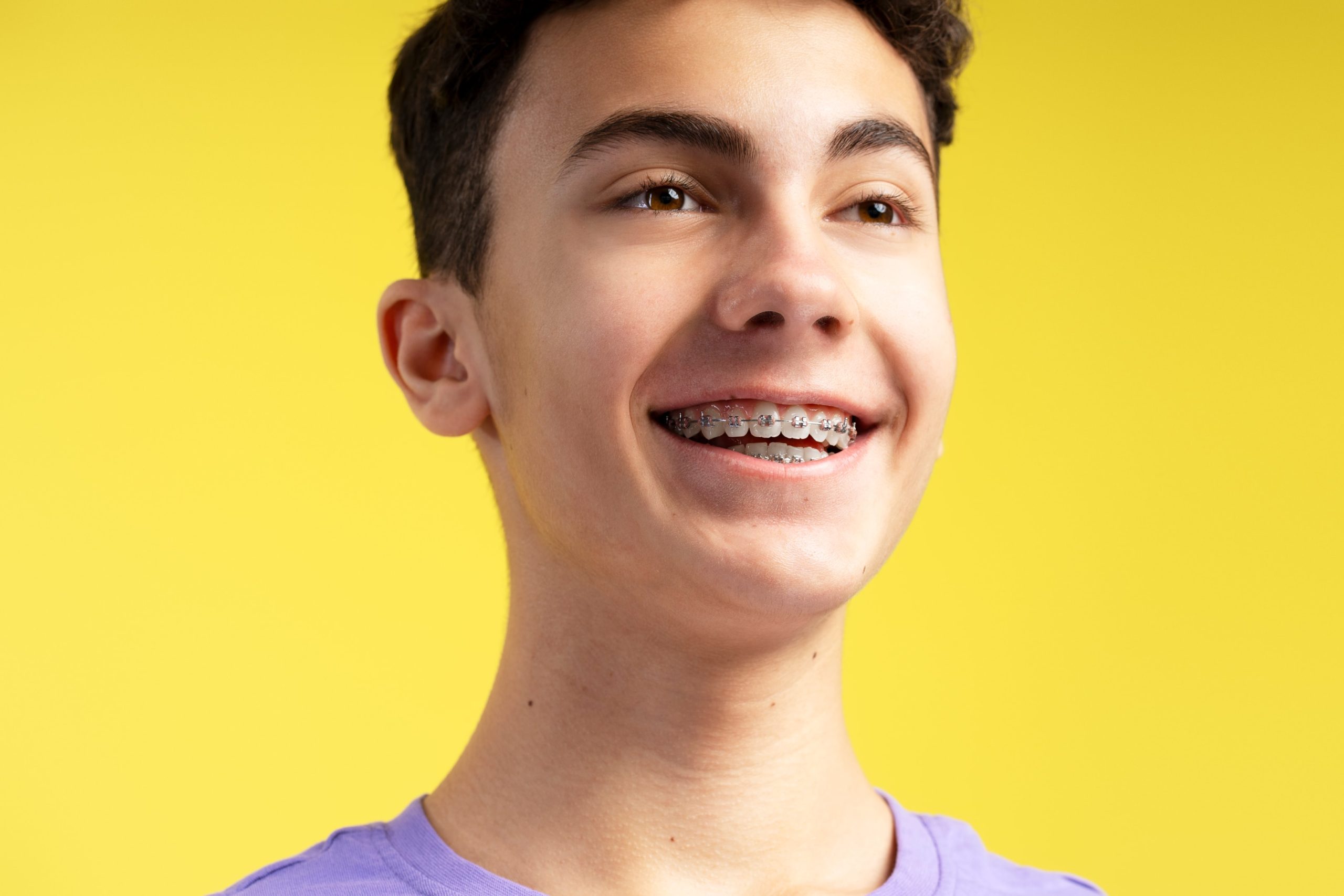 Boy wearing traditional metal braces for orthodontic treatment