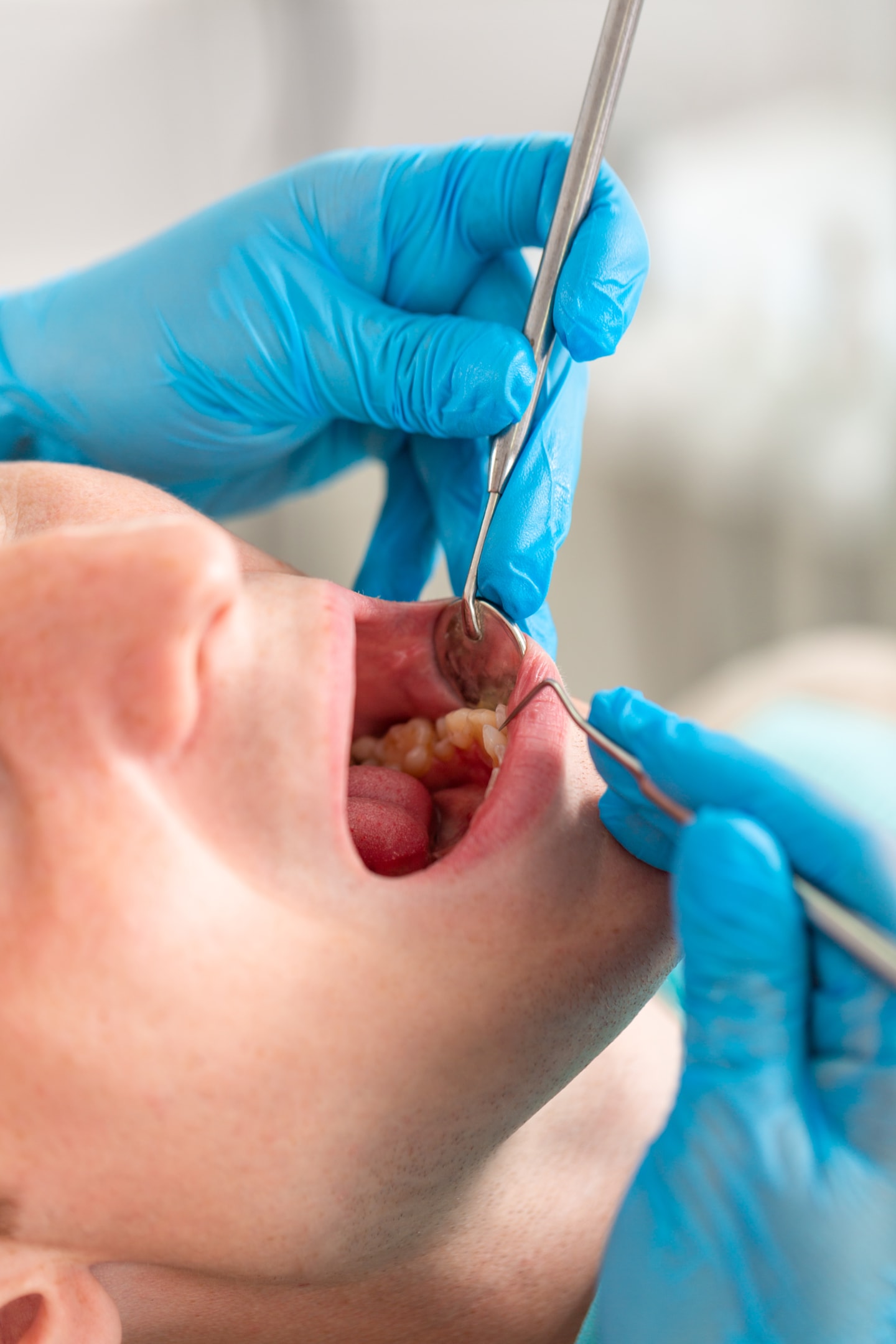 Patient getting checked to see if braces or Invisalign is needed