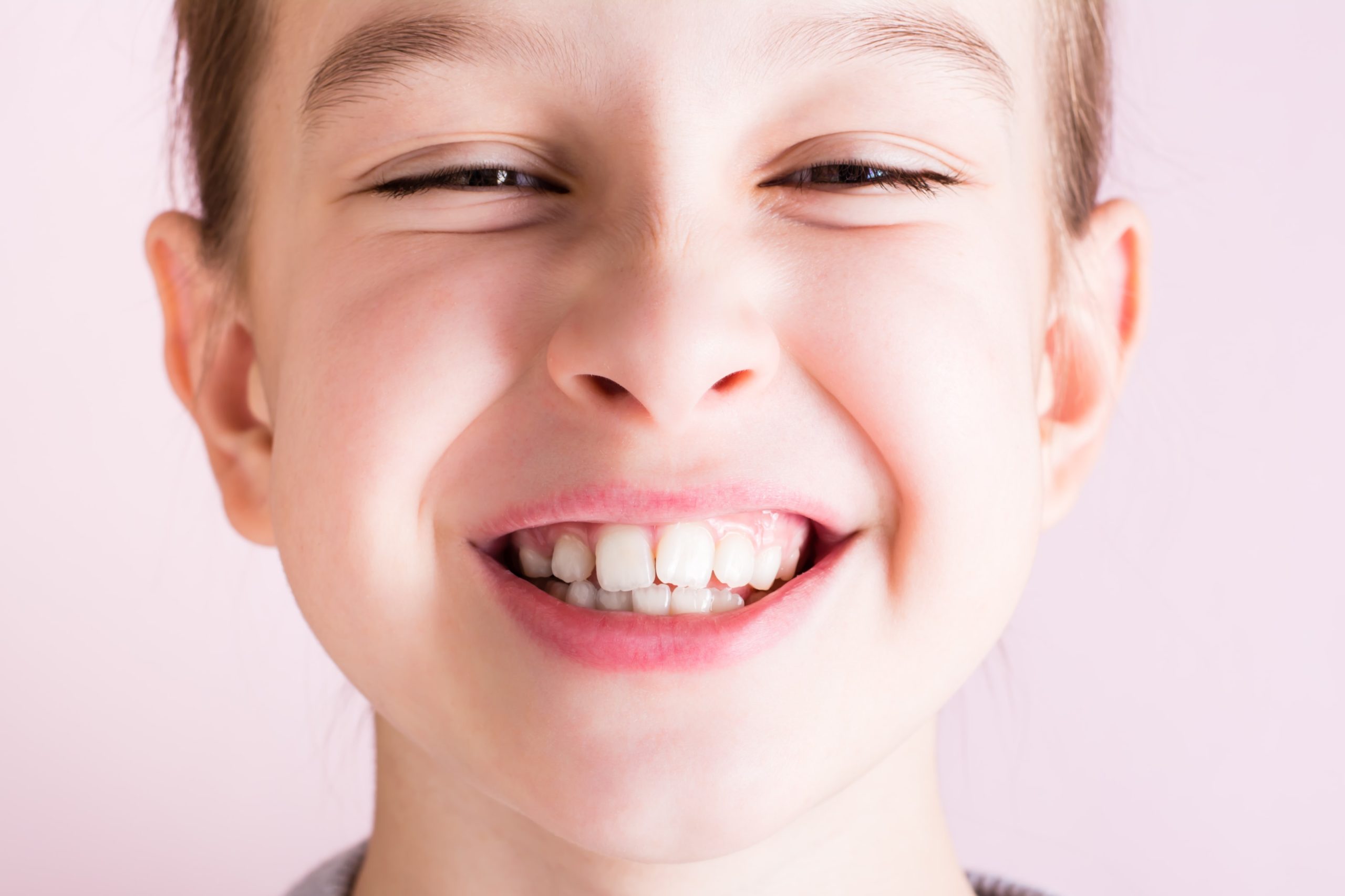 Girl smiling with crooked teeth 