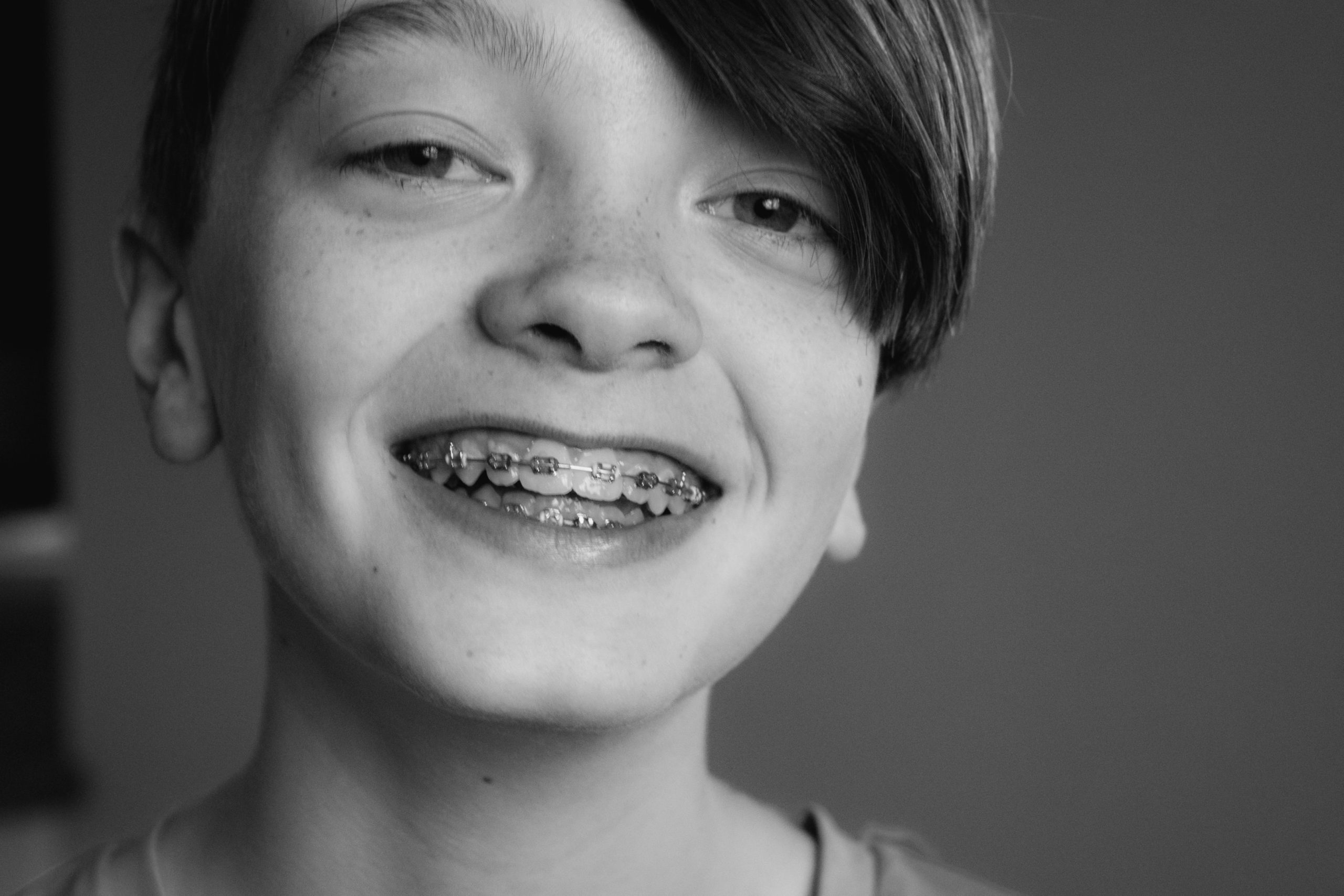 a boy receiving early orthodontic treatment