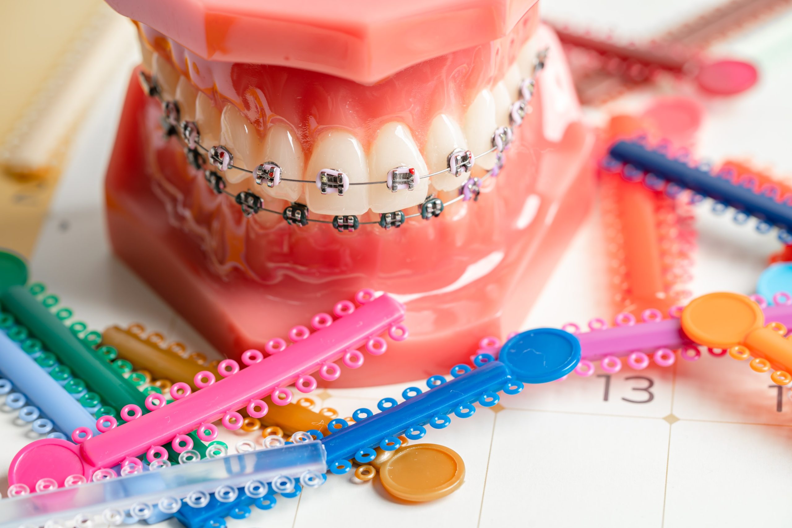 A picture of a braces with colorful rubbers.