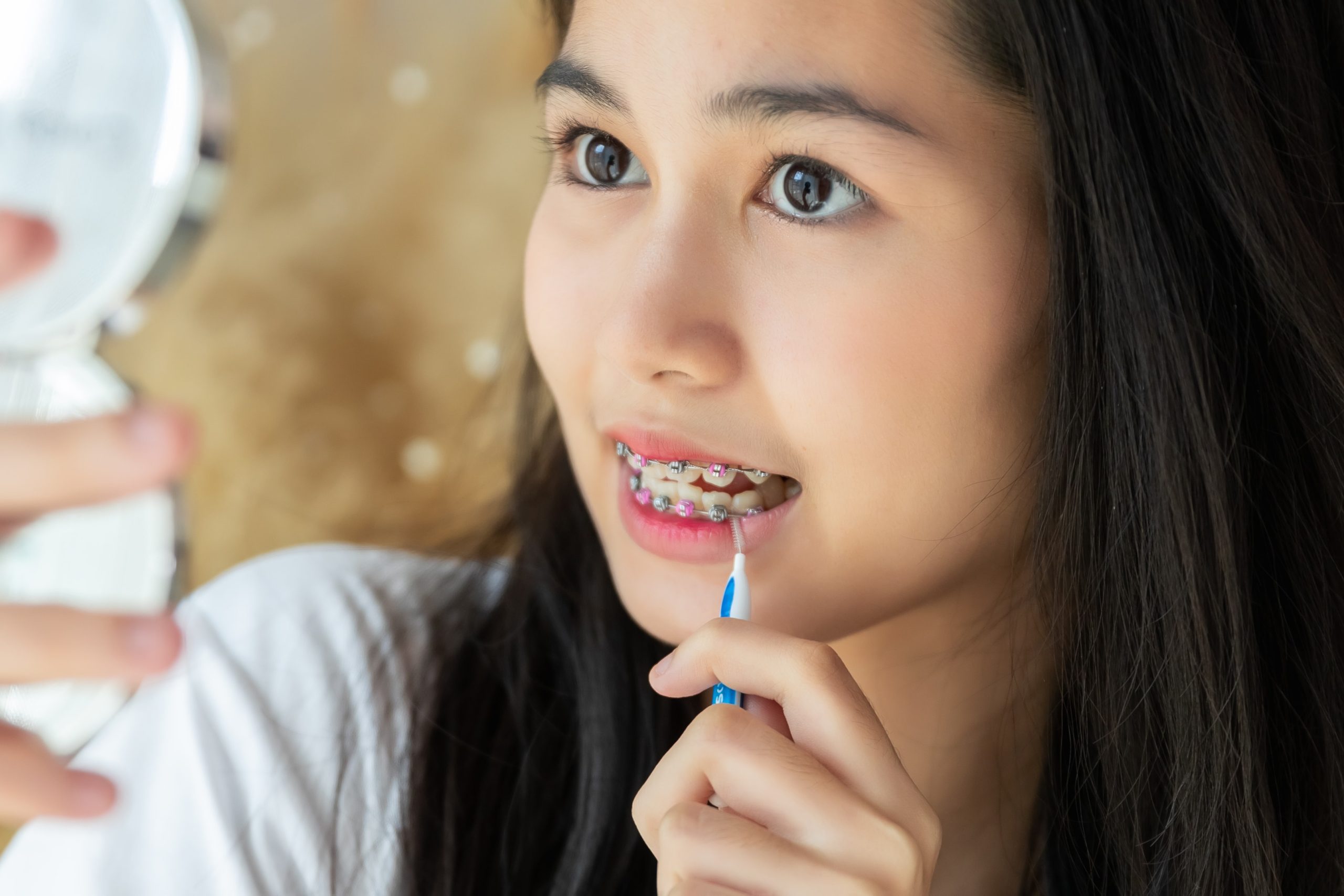 A photo of a girl showing her mouth and cleaning her braces