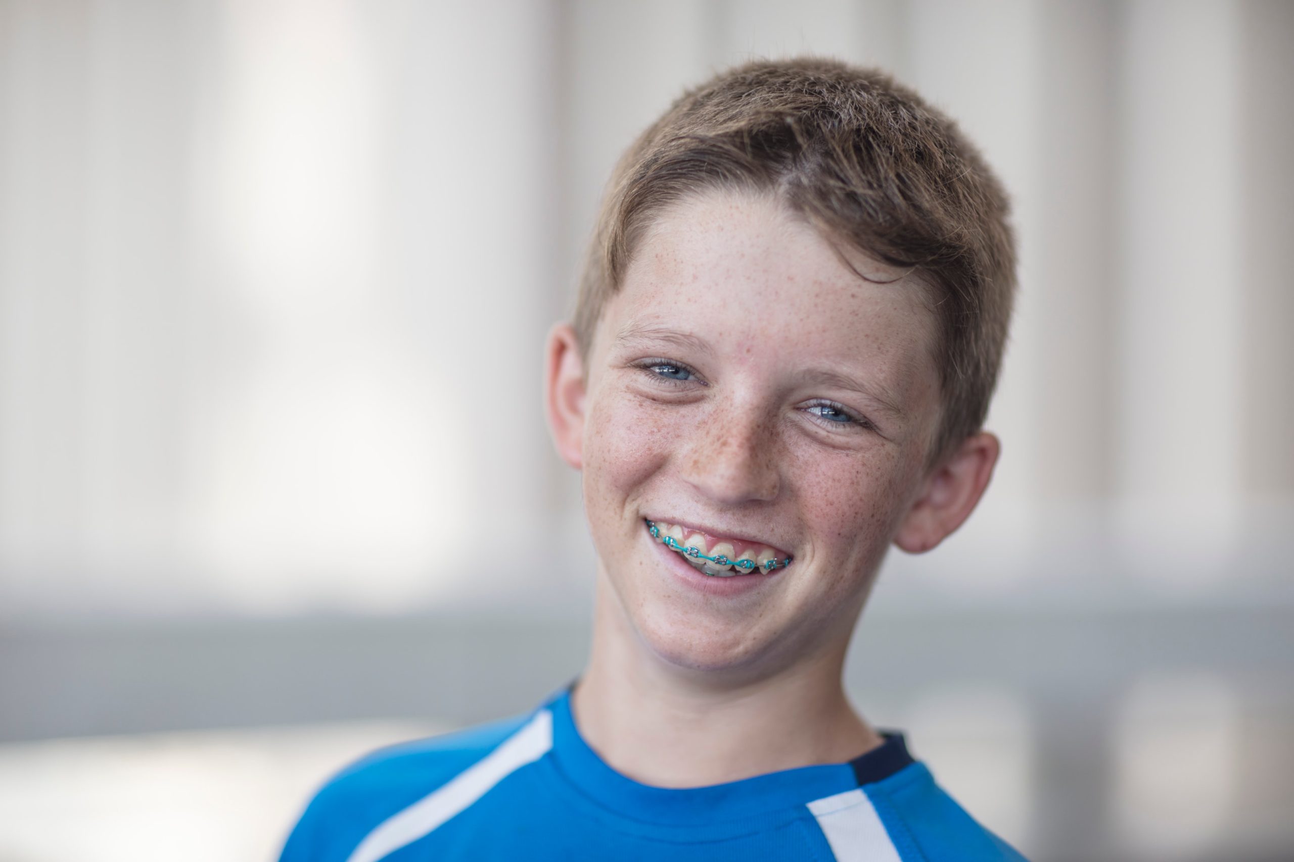 A young boy smiling with metal braces on his now straight teeth 