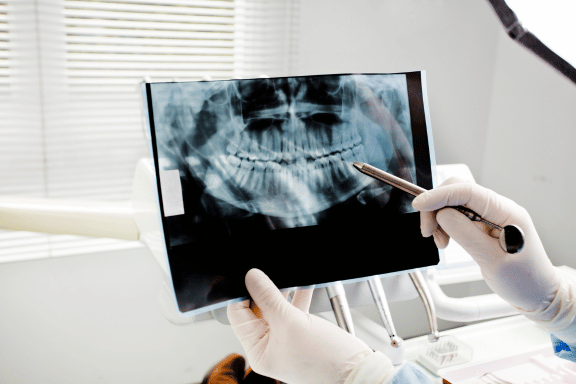 dr holding up a dental x-ray