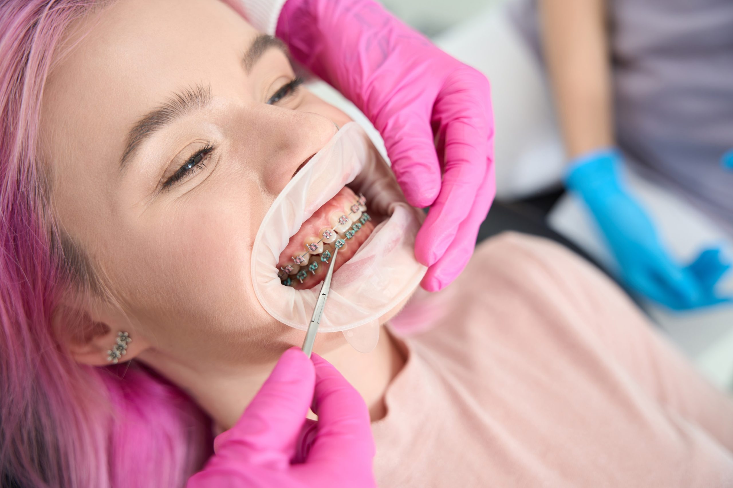 Teenager getting teeth ortho treatment