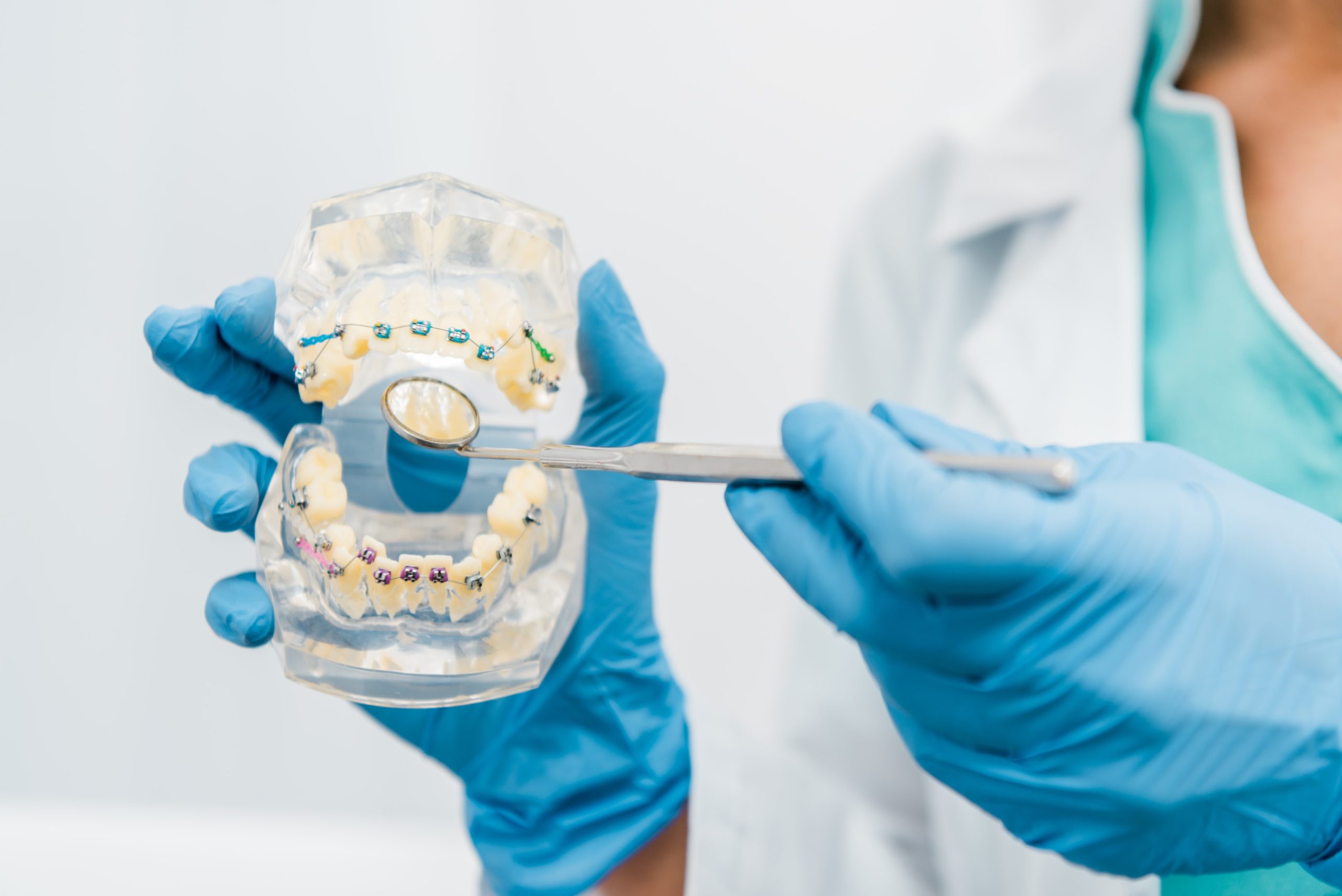 an orthodontist showing a dental model in metal braces straightening teeth