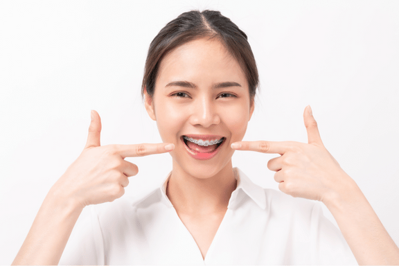 adult female pointing to her ceramic braces from her Calgary orthodontist