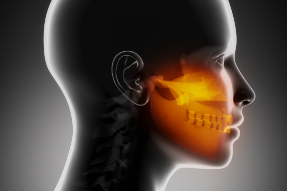 patient diagram after jaw surgery ready for the next step