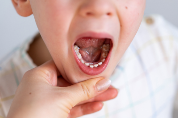 pulling baby teeth off a young boy