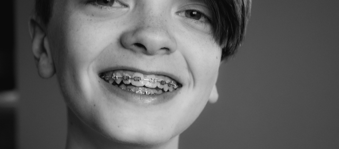 a boy with braces on his teeth smiling. His parents were concerned with braces cost
