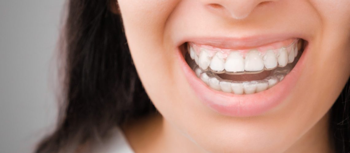 woman smiling while wearing Invisalign