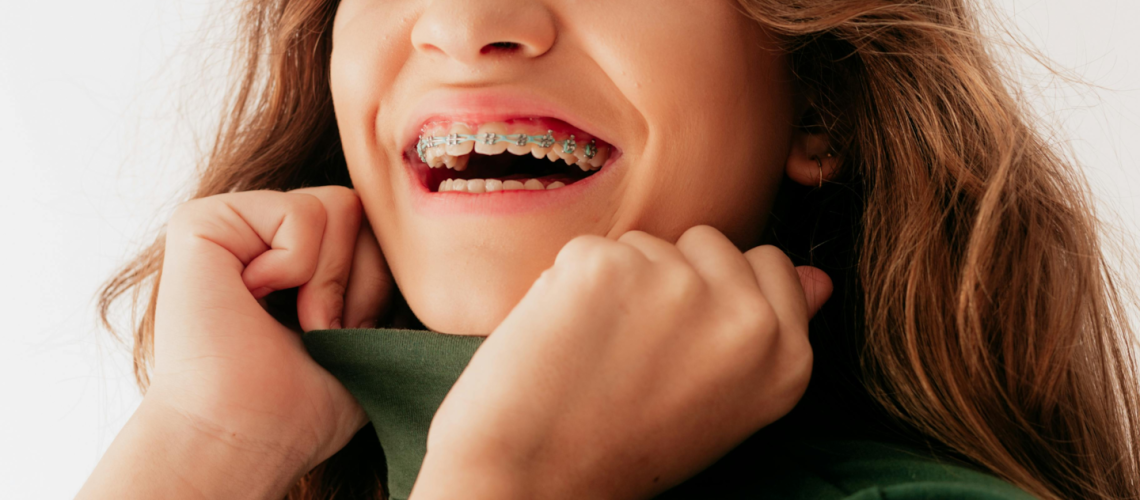 dental braces in calgary on a teen girl that is smiling